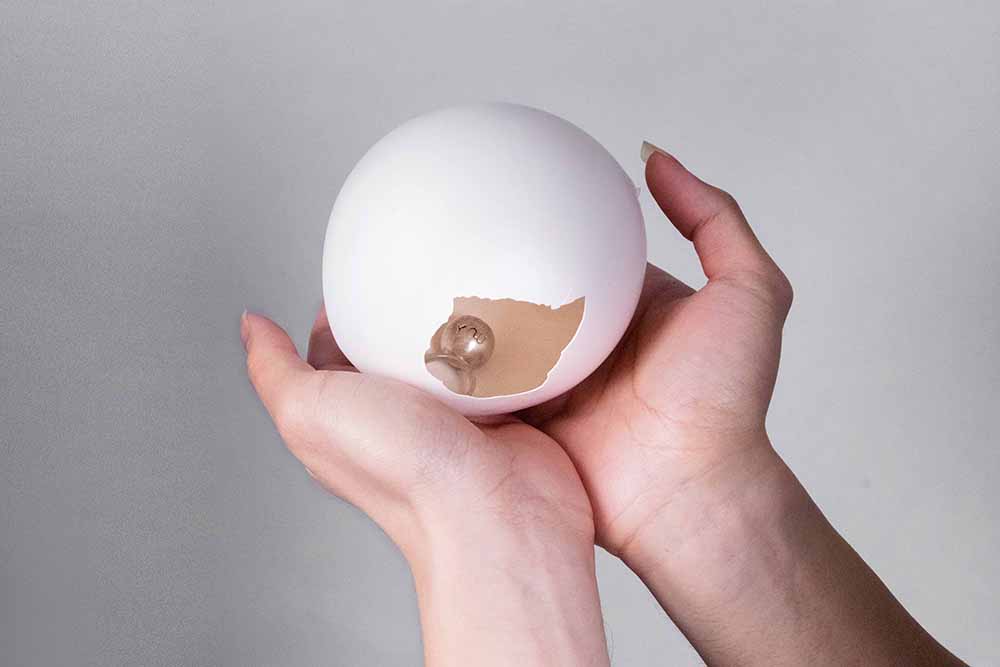 Wanrong Xie, Can you hear me? (inel)